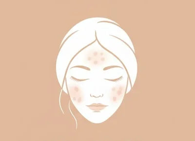 Produse profesionale pentru ten gras și predispus la acnee. Curățare eficientă, sebum control și reducerea imperfecțiunilor - Alissa Beaute